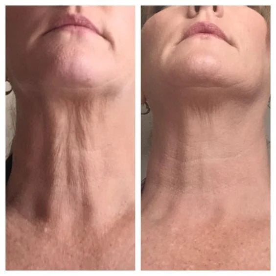 Crema Reafirmante de Cuello S10
