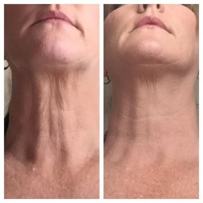 Crema Reafirmante de Cuello S10